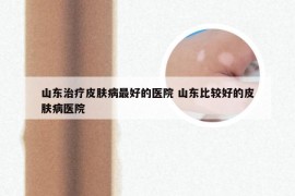 山东治疗皮肤病最好的医院 山东比较好的皮肤病医院