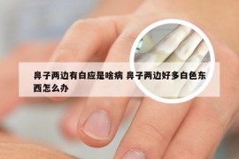 鼻子两边有白应是啥病 鼻子两边好多白色东西怎么办