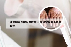 北京哪家医院治皮肤病 北京哪家医院治皮肤病好