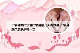 三氧自血疗法治疗银屑病几天有效果 三氧自血疗法多少钱一次