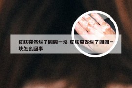 皮肤突然烂了圆圆一块 皮肤突然烂了圆圆一块怎么回事