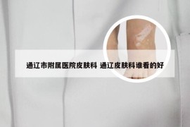 通辽市附属医院皮肤科 通辽皮肤科谁看的好