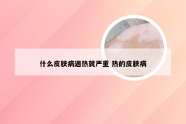 什么皮肤病遇热就严重 热的皮肤病