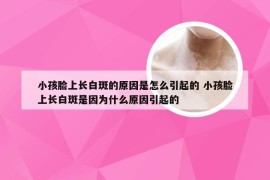 小孩脸上长白斑的原因是怎么引起的 小孩脸上长白斑是因为什么原因引起的