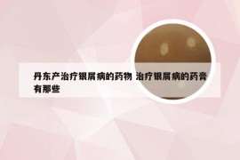 丹东产治疗银屑病的药物 治疗银屑病的药膏有那些