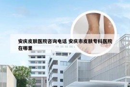 安庆皮肤医院咨询电话 安庆市皮肤专科医院在哪里