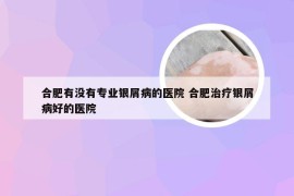 合肥有没有专业银屑病的医院 合肥治疗银屑病好的医院