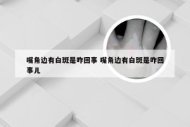 嘴角边有白斑是咋回事 嘴角边有白斑是咋回事儿