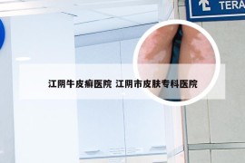 江阴牛皮癣医院 江阴市皮肤专科医院