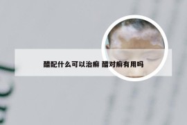 醋配什么可以治癣 醋对癣有用吗