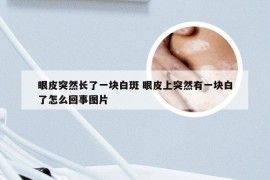 眼皮突然长了一块白斑 眼皮上突然有一块白了怎么回事图片