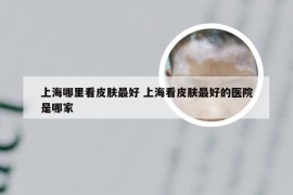 上海哪里看皮肤最好 上海看皮肤最好的医院是哪家
