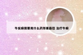 牛反癣需要用什么药郊果最侄 治疗牛癣