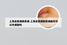 上海皮肤病银屑病 上海皮肤病银屑病医院可以开病假吗