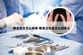 眼角变白怎么回事 眼角泛白是怎么回事儿