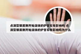 点滴型银屑刚开始涂抹的炉甘石有影响吗 点滴型银屑刚开始涂抹的炉甘石有影响吗为什么