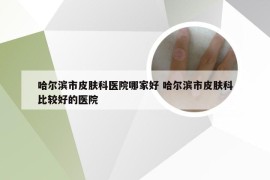 哈尔滨市皮肤科医院哪家好 哈尔滨市皮肤科比较好的医院