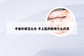 手被长癣怎么办 手上起的癣用什么药膏