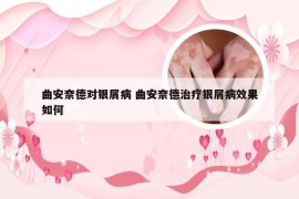 曲安奈德对银屑病 曲安奈德治疗银屑病效果如何