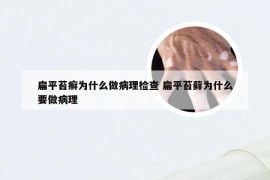扁平苔癣为什么做病理检查 扁平苔藓为什么要做病理