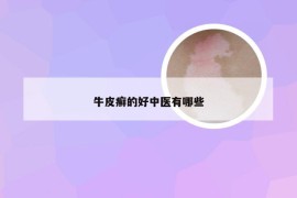 牛皮癣的好中医有哪些