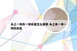 头上一块白一块白是怎么回事 头上有一块一块的白色