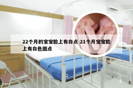 22个月的宝宝脸上有白点 21个月宝宝脸上有白色圆点