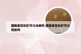 醋酸氟轻松酊可以治癣吗 醋酸氟轻松酊可以擦脸吗