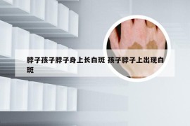 脖子孩子脖子身上长白斑 孩子脖子上出现白斑