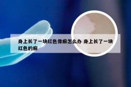 身上长了一块红色像癣怎么办 身上长了一块红色的癣