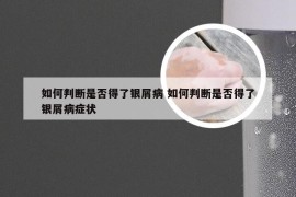 如何判断是否得了银屑病 如何判断是否得了银屑病症状
