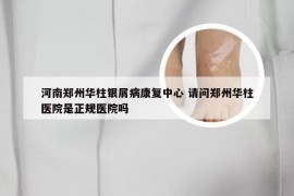 河南郑州华柱银屑病康复中心 请问郑州华柱医院是正规医院吗