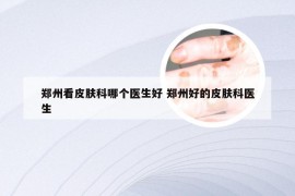 郑州看皮肤科哪个医生好 郑州好的皮肤科医生