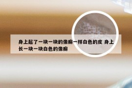 身上起了一块一块的像癣一样白色的皮 身上长一块一块白色的像癣