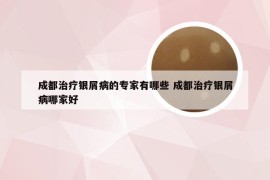 成都治疗银屑病的专家有哪些 成都治疗银屑病哪家好