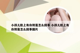 小孩儿脸上有白斑是怎么回事 小孩儿脸上有白斑是怎么回事图片