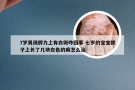 7岁男孩脖力上有白斑咋回事 七岁的宝宝脖子上长了几块白色的癣怎么治