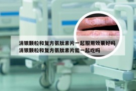 消银颗粒和复方氨肽素片一起服用效果好吗 消银颗粒和复方氨肽素片能一起吃吗