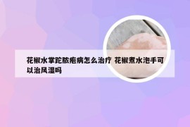 花椒水掌跎脓疱病怎么治疗 花椒煮水泡手可以治风湿吗