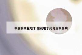 牛皮癣紫花地丁 紫花地丁药膏治银屑病