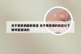 关于银屑病最新报道 关于银屑病的叙述以下哪项是错误的