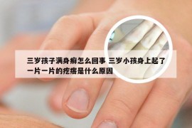 三岁孩子满身癣怎么回事 三岁小孩身上起了一片一片的疙瘩是什么原因