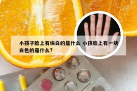 小孩子脸上有块白的是什么 小孩脸上有一块白色的是什么?