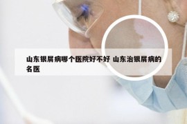 山东银屑病哪个医院好不好 山东治银屑病的名医