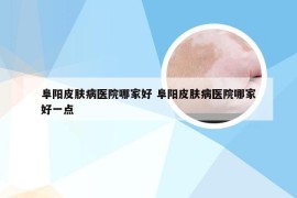 阜阳皮肤病医院哪家好 阜阳皮肤病医院哪家好一点