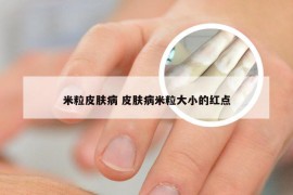 米粒皮肤病 皮肤病米粒大小的红点