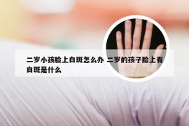 二岁小孩脸上白斑怎么办 二岁的孩子脸上有白斑是什么