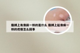 胳膊上有像藓一样的是什么 胳膊上起像癣一样的疙瘩怎么回事