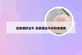 皮肤病好治不 皮肤病治不好的有哪些