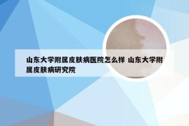 山东大学附属皮肤病医院怎么样 山东大学附属皮肤病研究院